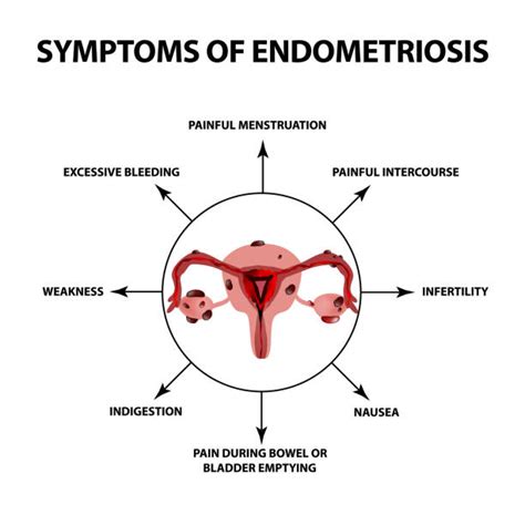 endometriosis definition dictionary